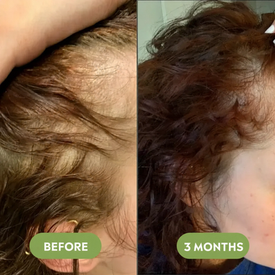 Korean Herbal Scalp Bar - GlamX